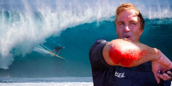 7 consigli per fare surf su fondali rocciosi o corallini senza farsi male